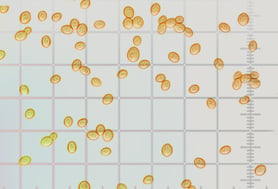 Cell Counting Your Yeast Culture