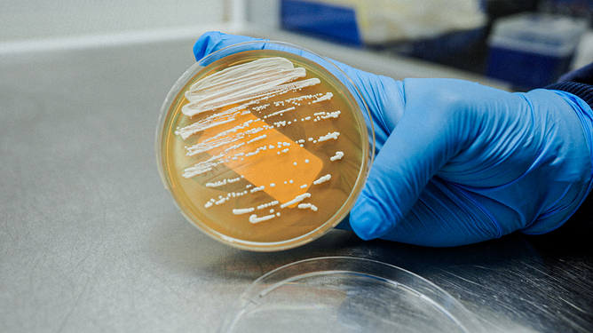 Yeast_Plate