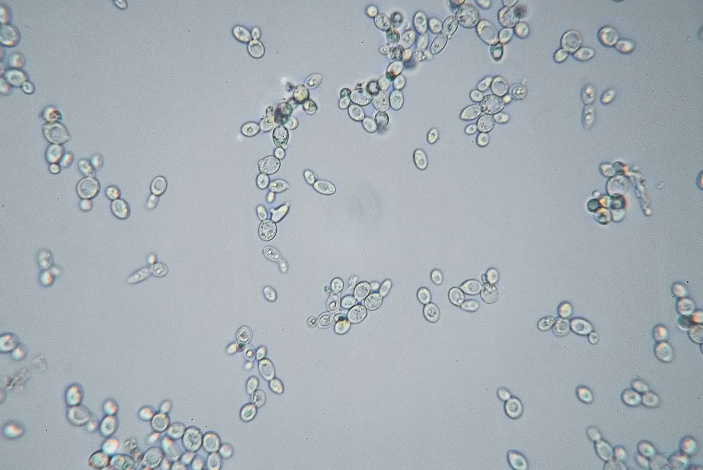 Yeast_Cells_01